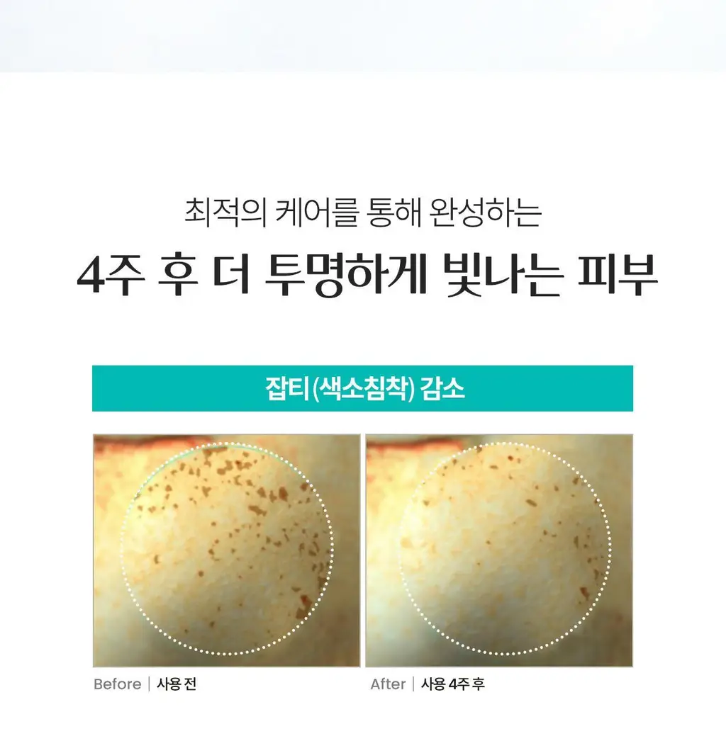 [3STEP 멜라닌 클리어] 리쥬란 힐러 트리플 래디언스 크림 50ml 상세페이지 31